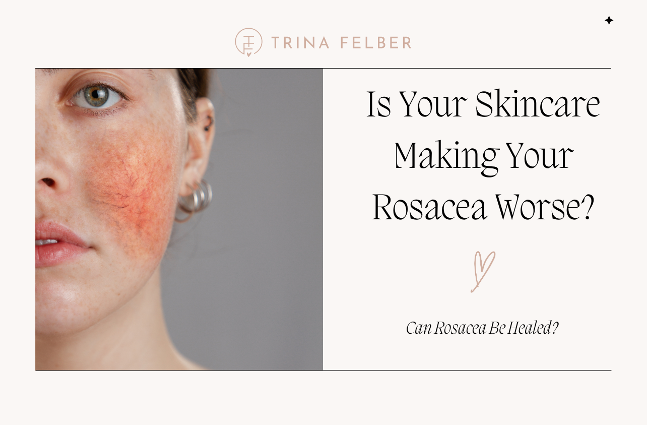 Is Your Skincare Making Rosacea Worse?